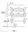 Fig. 07 - Image reconstruction method for cardiac gated magnetic resonance imaging