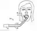 Fig. 01 - Medical sensor and technique for using the same