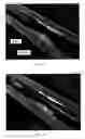 Fig. 08 - Blood-flow-occluding, temperature-sensing catheters with elastic covers