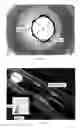 Fig. 10 - Blood-flow-occluding, temperature-sensing catheters with elastic covers