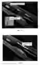 Fig. 11 - Blood-flow-occluding, temperature-sensing catheters with elastic covers