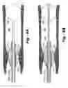 Fig. 13 - Blood-flow-occluding, temperature-sensing catheters with elastic covers
