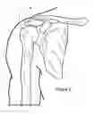 Fig. 03 - Biofidelic shoulder brace