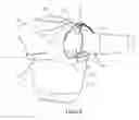 Fig. 05 - Biofidelic shoulder brace
