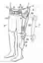 Fig. 01 - Walking assistance device