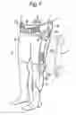 Fig. 02 - Walking assistance device