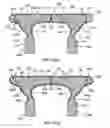 Fig. 23 - Knee brace