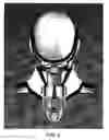 Fig. 12 - Traction collar and method of use
