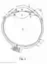 Fig. 02 - Implantable pump apparatuses
