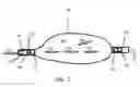 Fig. 05 - Implantable pump apparatuses