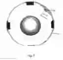 Fig. 07 - Implantable pump apparatuses