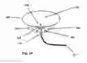 Fig. 12 - Implantable pump apparatuses