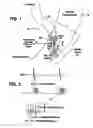 Fig. 02 - Method and System for Myocardial Infarction Repair