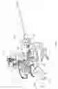 Fig. 05 - Medical suction and irrigation device