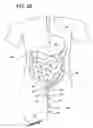 Fig. 05 - Gastrointestinal applicator and method of using same