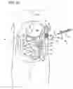 Fig. 06 - Gastrointestinal applicator and method of using same