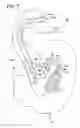 Fig. 10 - Gastrointestinal applicator and method of using same