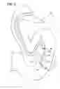 Fig. 12 - Gastrointestinal applicator and method of using same