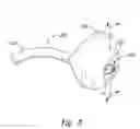 Fig. 04 - Systems and methods for securing cardiovascular tissue, including via asymmetric inflatable members