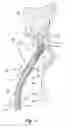Fig. 05 - Systems and methods for securing cardiovascular tissue, including via asymmetric inflatable members