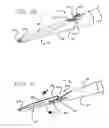 Fig. 07 - Peg tube with wireless pull tip