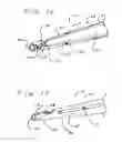 Fig. 10 - Peg tube with wireless pull tip