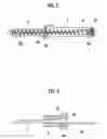 Fig. 03 - Indwelling needle