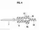 Fig. 04 - Indwelling needle