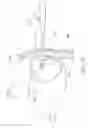Fig. 13 - METHOD AND APPARATUS FOR EXTENDING FEEDING TUBE LONGEVITY