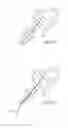 Fig. 05 - Systems and methods for dilating and accessing body lumens