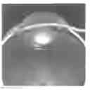 Fig. 01 - Ocular pressure regulation