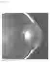 Fig. 02 - Ocular pressure regulation