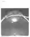 Fig. 03 - Ocular pressure regulation
