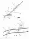 Fig. 22 - Access and closure device and method