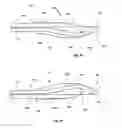 Fig. 25 - Access and closure device and method