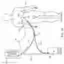 Fig. 04 - Method and apparatus for peritoneal hypothermia and/or resuscitation