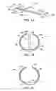 Fig. 03 - Methods and kits for delivering pharmaceutical agents into the coronary vascular adventitia
