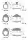 Fig. 07 - Methods and kits for delivering pharmaceutical agents into the coronary vascular adventitia