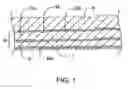 Fig. 02 - Methods and kits for delivering pharmaceutical agents into the coronary vascular adventitia