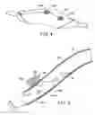 Fig. 06 - Methods and kits for delivering pharmaceutical agents into the coronary vascular adventitia