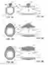 Fig. 07 - Methods and kits for delivering pharmaceutical agents into the coronary vascular adventitia