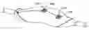 Fig. 01 - Methods and kits for delivering pharmaceutical agents into the coronary vascular adventitia