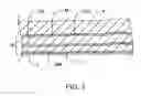 Fig. 02 - Methods and kits for delivering pharmaceutical agents into the coronary vascular adventitia