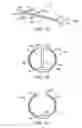 Fig. 03 - Methods and kits for delivering pharmaceutical agents into the coronary vascular adventitia