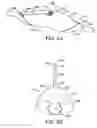 Fig. 04 - Methods and kits for delivering pharmaceutical agents into the coronary vascular adventitia