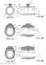 Fig. 07 - Methods and kits for delivering pharmaceutical agents into the coronary vascular adventitia