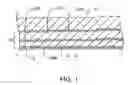 Fig. 02 - Methods and kits for delivering pharmaceutical agents into the coronary vascular adventitia