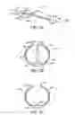 Fig. 03 - Methods and kits for delivering pharmaceutical agents into the coronary vascular adventitia