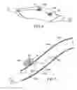 Fig. 06 - Methods and kits for delivering pharmaceutical agents into the coronary vascular adventitia