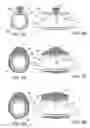 Fig. 07 - Methods and kits for delivering pharmaceutical agents into the coronary vascular adventitia